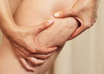 Celulita, o problema? Scapa de ea