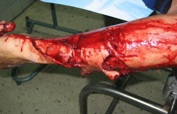 Imagini socante! Un barbat a fost zdrobit de un caine