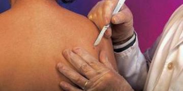Adolescentii mai predispusi la cancer decat adultii