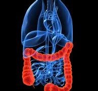 Martie  este “Luna Internationala de Lupta Impotriva Cancerului Intestinului Gros”?